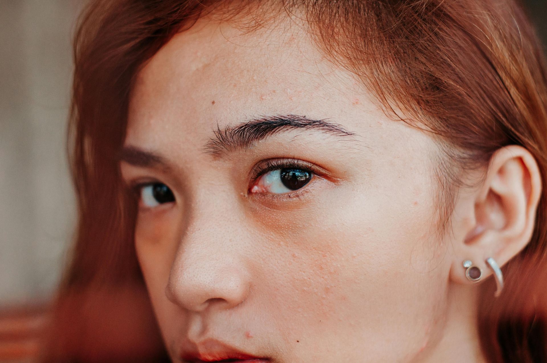 Causes of earache (image sourced via Pexels / Photo by the giansepillo)
